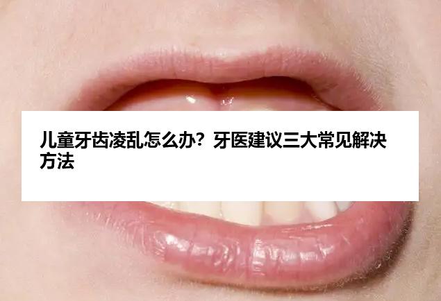 儿童牙齿凌乱怎么办？牙医建议三大常见解决方法