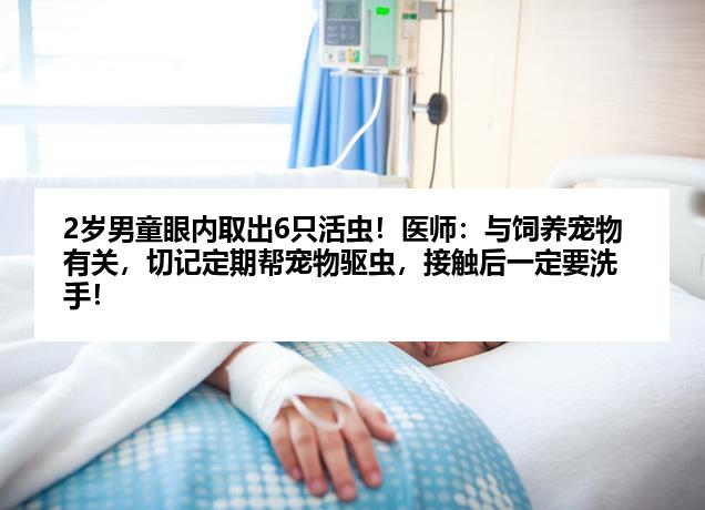 2岁男童眼内取出6只活虫！医师：与饲养宠物有关，切记定期帮宠物驱虫，接触后一定要洗手！