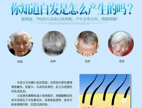 白头发可以拔吗？怎样才能变回黑发？中西医教你正确的白头发预防之道！