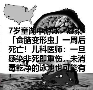 7岁童湖中游泳，感染「食脑变形虫」一周后死亡！儿科医师：一旦感染非死即重伤，未消毒乾净的泳池也可能有！