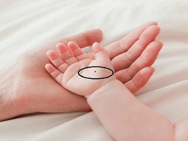 我以为我有一个幸运的痣,谁怀疑是血管瘤!