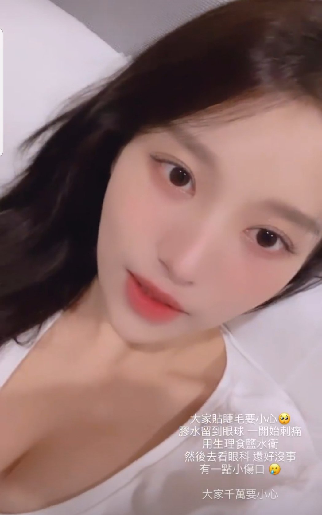 「姐姐的朋友」确诊康复又就医曝伤口状况：千万小心！