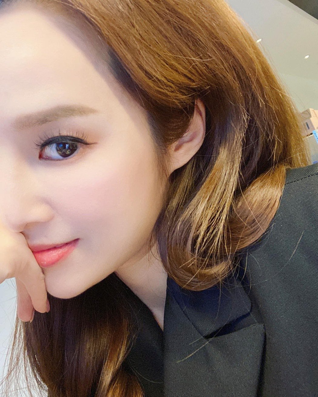 三立主播张龄予确诊后脑勺像被棍棒打过肿起来