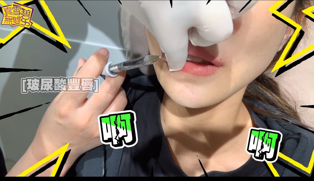 「教主」年轻的阿姨雪碧记录「微整」过程　针插脸部嘴唇画面曝光