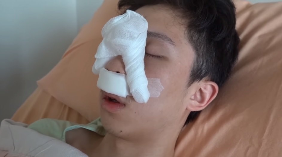 孙安佐自曝手术住院手肿咳血痰　终于解决多年隐疾