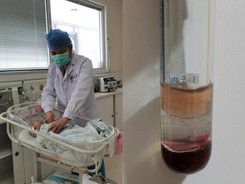 2个月娃咳嗽送急诊，抽出「黏稠牛奶血」，检查竟是因为：家长奶粉冲太浓！