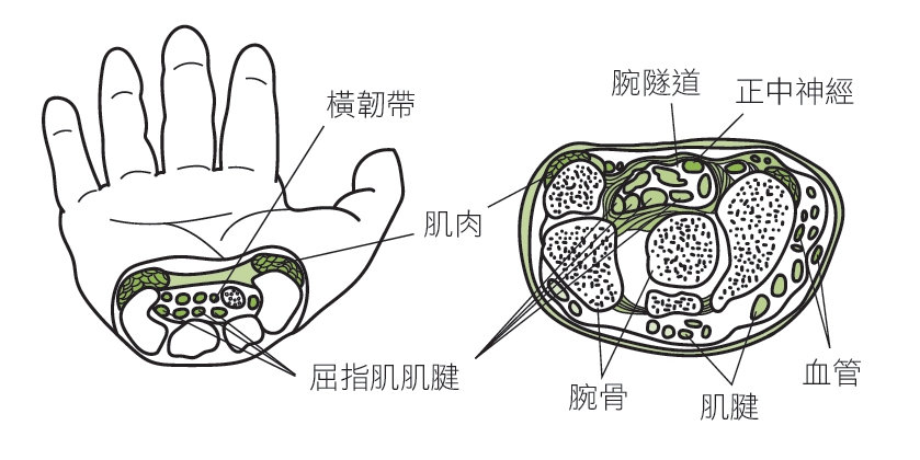 抱小孩快调整成3姿势！手腕卡卡又酸痛，伸展、按摩、牵拉图解法让妈妈不再