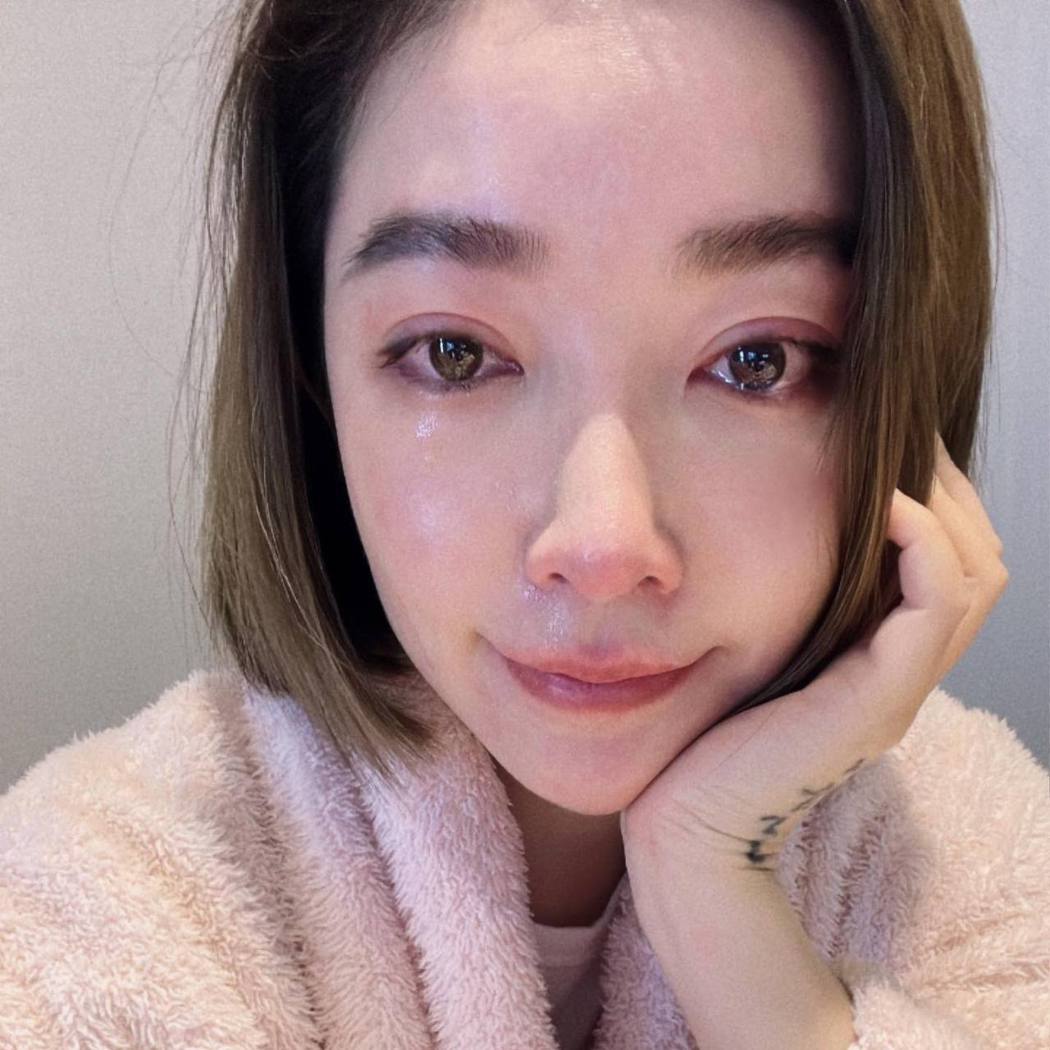 朋友的姐姐许维恩哭红眼！取卵过程「艰辛疼痛」认年纪已晚了