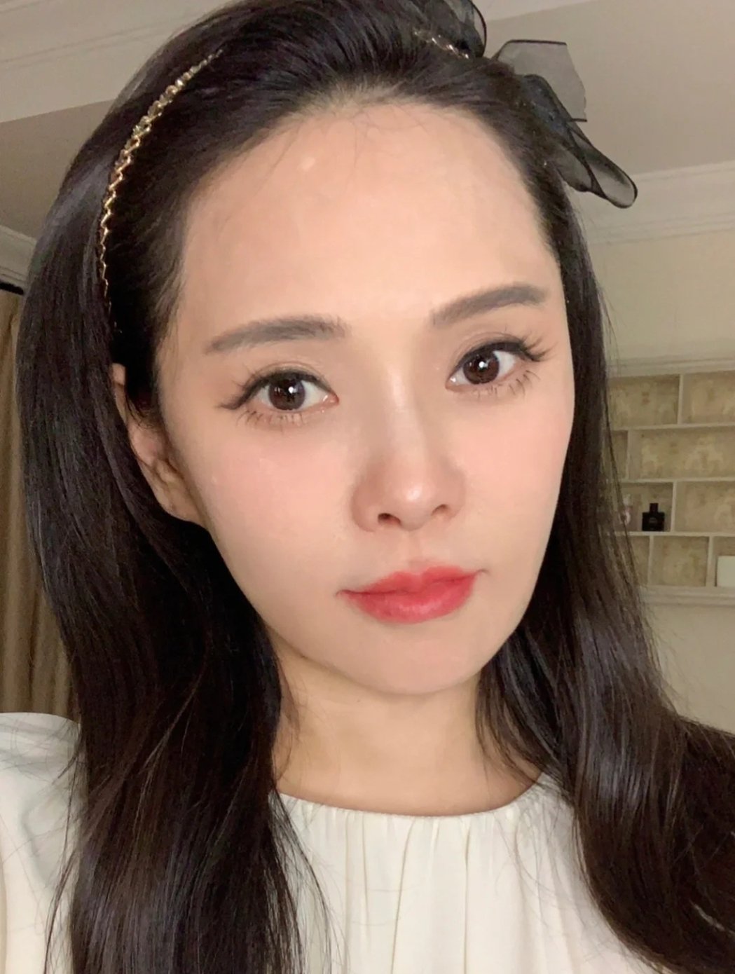 额头白点被疑整形年轻的阿姨伊能静亲揭背后感人真相