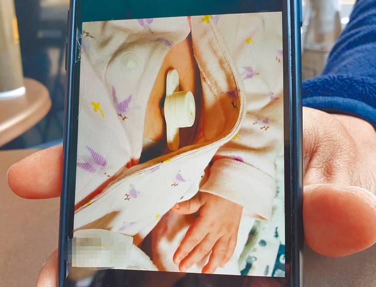 爸爸:她生命是计时的,最大安慰是已活过3岁半