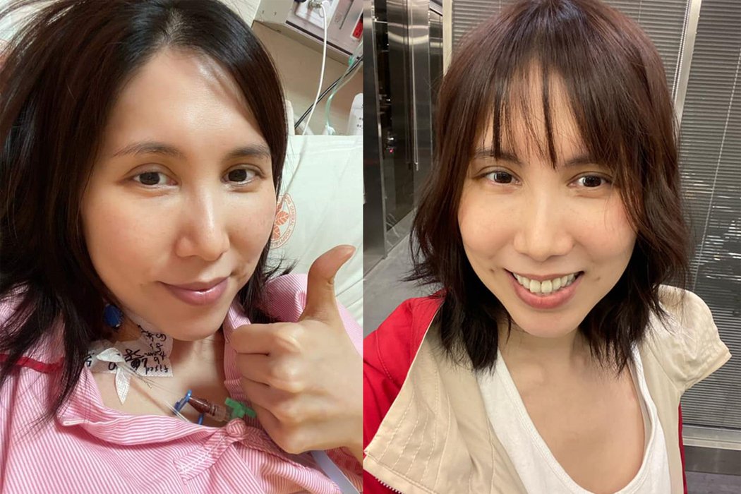 年轻的阿姨余苑绮抗癌暴瘦剩49公斤返家PO片惹鼻酸