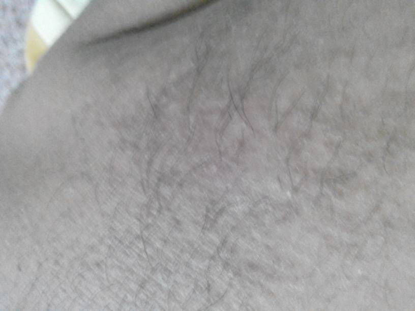 男人体毛多,性欲就强?