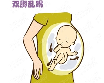 临产前宝宝脐带绕颈胎死腹中,准妈你注意胎动了吗?