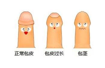 男儿当自强:男人要包容,不用包皮!
