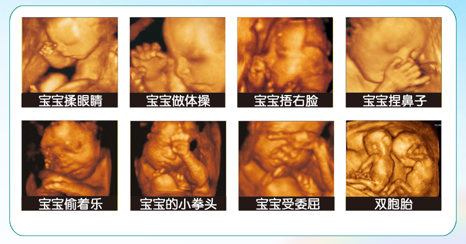 专家：普通二维B超孕检正常,无需再做四维彩超