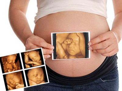孕期做四维彩超的最佳时间？什么是三维彩超?四维彩超?