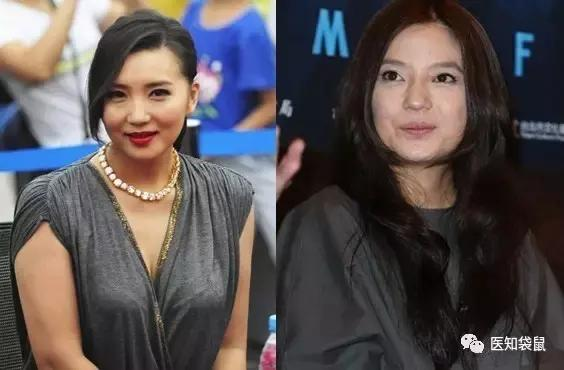 妇产科医生教你 产后快速瘦身:有效又不伤身！