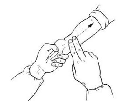 小儿推拿退烧六步图5 小儿推拿退烧六步图