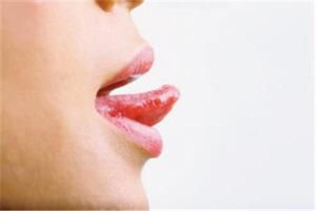 舌苔厚白吃什么药