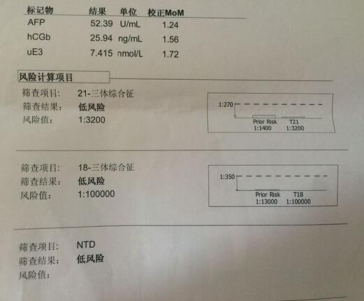 唐筛什么时候做3 唐筛什么时候做