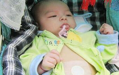 丁桂儿脐贴怎么贴_ 丁桂儿脐贴怎么贴  丁桂儿脐贴的注意事项