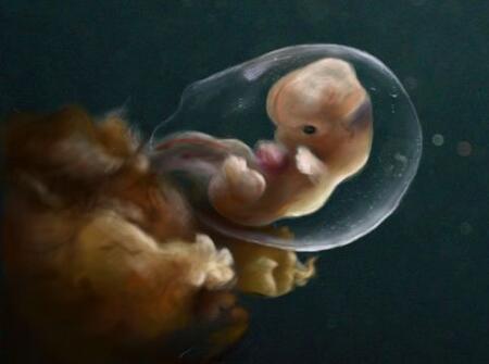 小儿黄疸指标2 小儿黄疸指数正常值是多少 宝宝黄疸正常值是多少