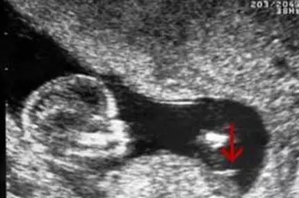 2017生男生女计算器