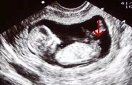 2017生男生女计算器