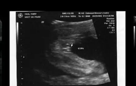 2017生男生女计算器