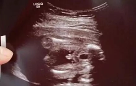 2017生男生女计算器