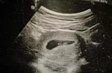 2017生男生女计算器