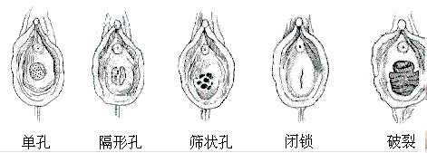 揭开：女性生理生殖器羞于启齿的秘密