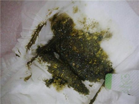 新生儿大便颜色对照表，史上最全的便便对照表