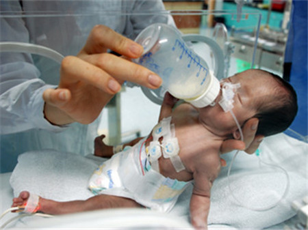 早产儿什么时候可以出院3 早产儿什么时候可以出院,出院回家护理要注意什么