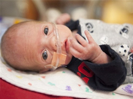 早产儿什么时候可以出院2 早产儿什么时候可以出院,出院回家护理要注意什么