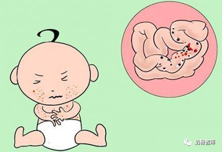 如何区分牛奶蛋白过敏和乳糖不耐受症?