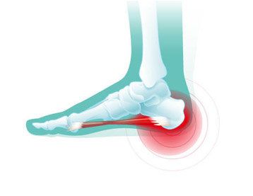 脚后跟疼是什么原因?跟痛症的发病原因