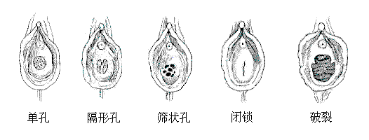 史上最真实的女人阴道图片