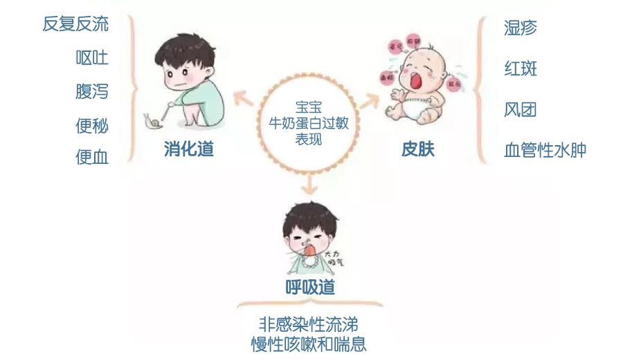 宝宝牛奶过敏怎么办 18个常见问题一次全解决