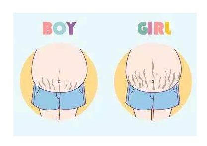 你相信吗?一条妊娠线就能判断生男生女!
