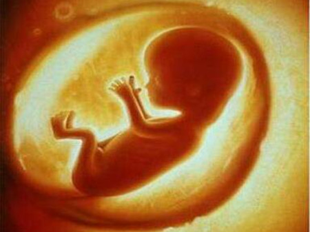 脉络丛囊肿是怎么引起的