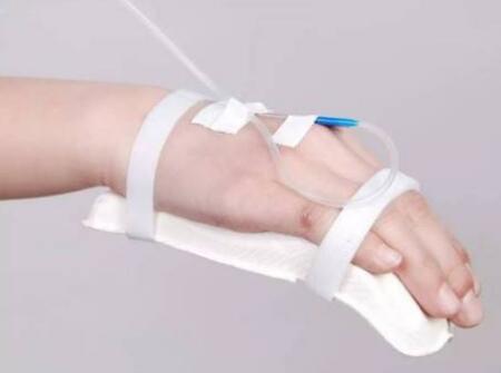 新生儿急性肾衰竭怎么办