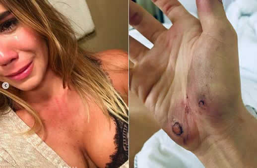 名模女星遭家暴照片:她经历了什么真相触目惊心