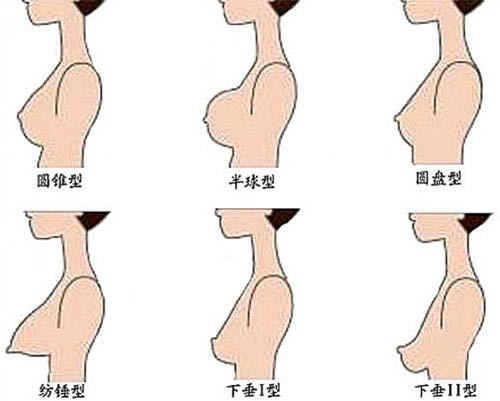 女人正确挑选适合自己的内衣：选内衣看乳房形状