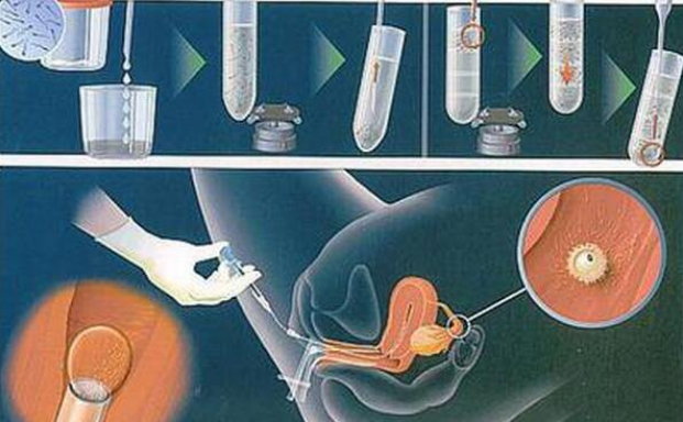 涨知识：详解人工授精与试管婴儿不同之处