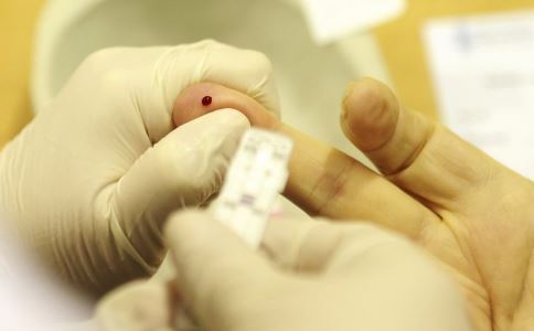 女子骗闺蜜染艾滋 识别艾滋病的早期症状