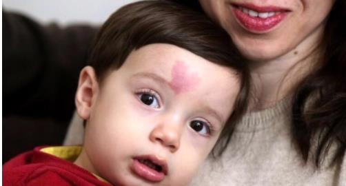 身上带有胎记的人是怎么回事：关于胎记的传说详解