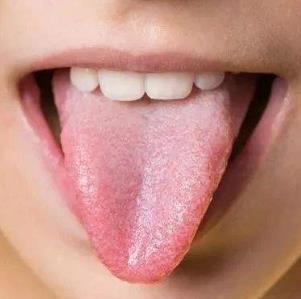 女性体内湿气重的6种表现，体内湿气重如何调理