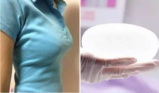 女人隆胸的危害有哪些:4大自然丰胸方法助你罩杯提升