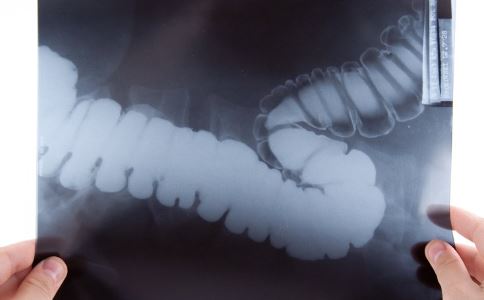 美国确诊超600例超级真菌 患者感染后会有哪些症状